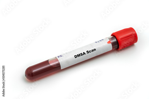 DMSA Scan Medical check up test tube with biological sample photo