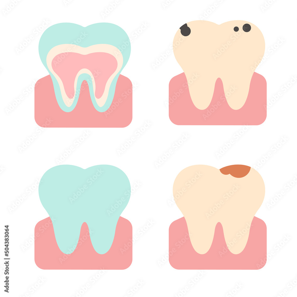 Vector set of teeth in different states. Flat illustration Vector set of teeth in different states. Flat illustration