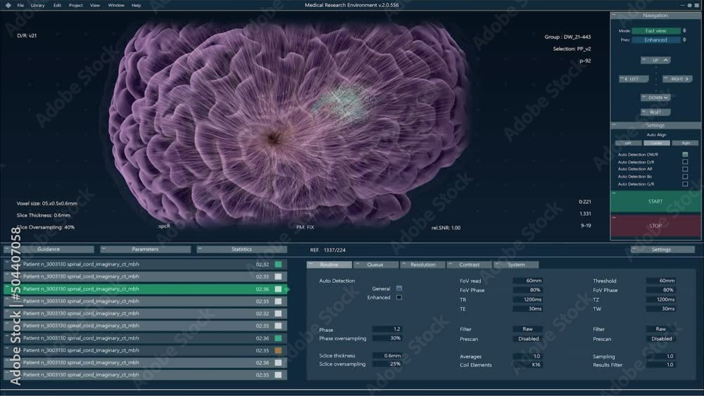 Brain Activity Monitoring System Mock-up with Multiple Windows and Data ...