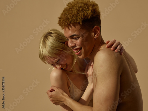 Happy and comfortable couple - spontaneous - skincare - scars - nature