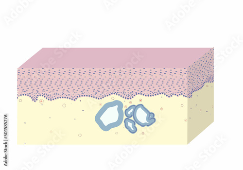 morphology of endocervicosis under a microscope, illustration, vector