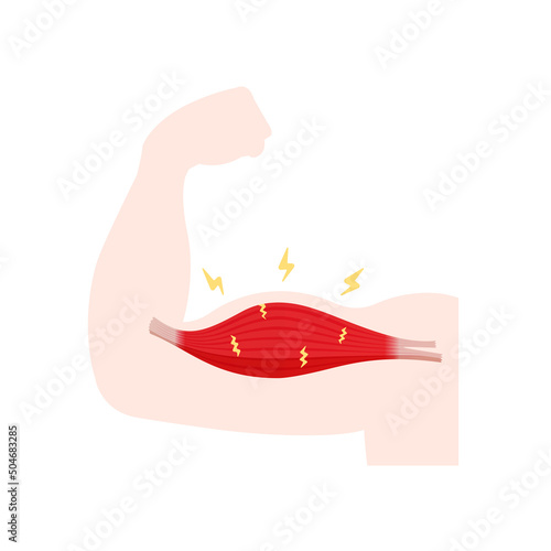 Vector illustration of muscle damage ( after training )