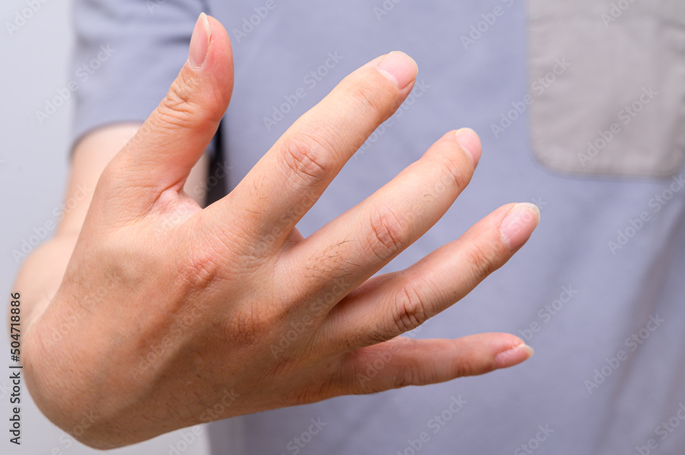 Hands of men suffering from finger joint pain. Causes of rheumatoid
