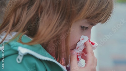 Sad Caucasian Girl Trying to Stop Nose Bleeding using Paper Tissue Side photo