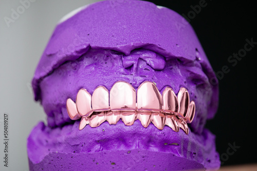 Grillz - Dental Jewelry photo