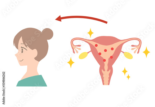 Illustration of a young woman's uterus with high estrogen levels.