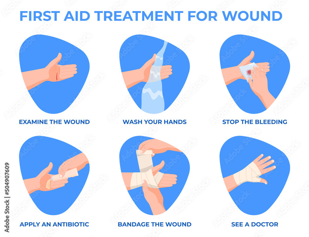 Scrape Hand First aid for hand injuries. Bandage of a human hand. Vector ...