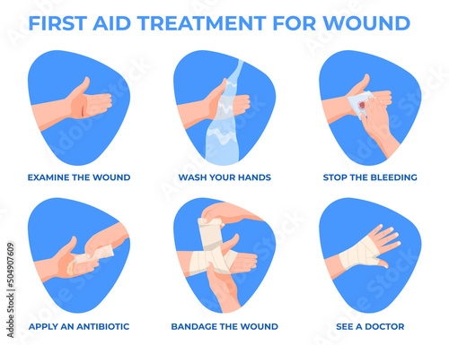 First aid for hand injuries. Bandage of a human hand. Vector illustration