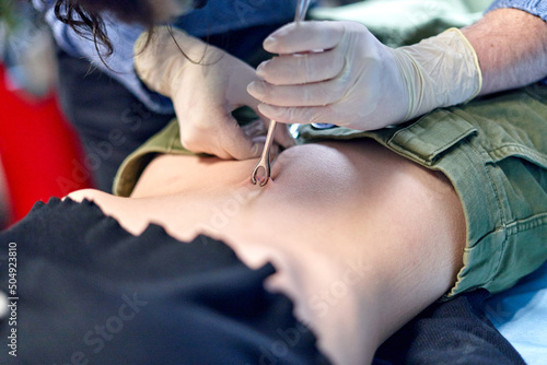 Crop piercer using forceps on belly button of woman