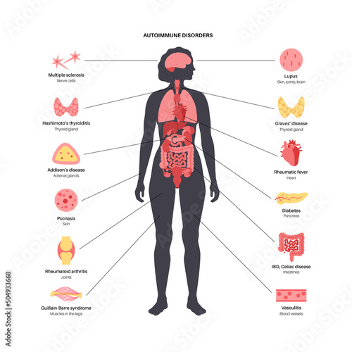 Autoimmune disorders diseases