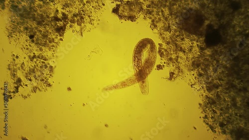 Nematode - microscopic worm photo