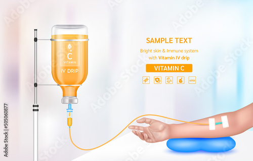 Vitamin iv drip treatment. Needle Intravenous for infusion on arm in clinic with warm tone. Vitamin C serum collagen orange inside saline bottle. Medical and beauty concept. Vector EPS 10.