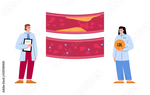 Doctors check cholesterol and vein patency, flat vector illustration isolated.