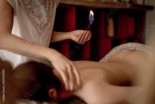 Foto Detail of an acupuncture therapist placing a glass globe in a fire cupping procedure, chinese medicine