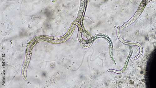 nematode in compost, in soil under the microscope	 photo