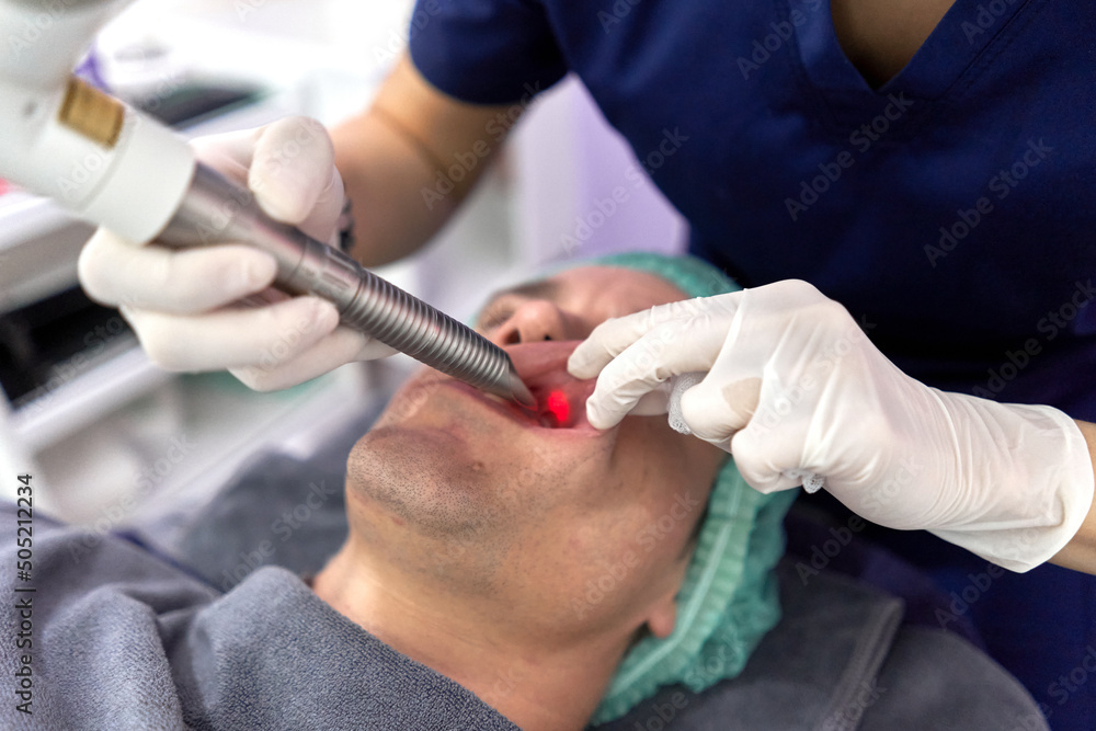 Doctor pulling a man's lip apart for an intraoral laser beauty