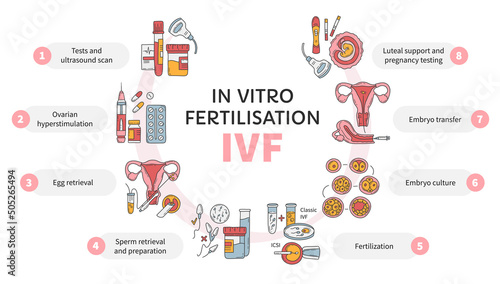 In Vitro fertilization IVF vector circle infographic, infertility treatment scheme. Ovarian hyperstimulation, artificial insemination, embryo culture, luteal support. Medical procedure for pregnancy photo