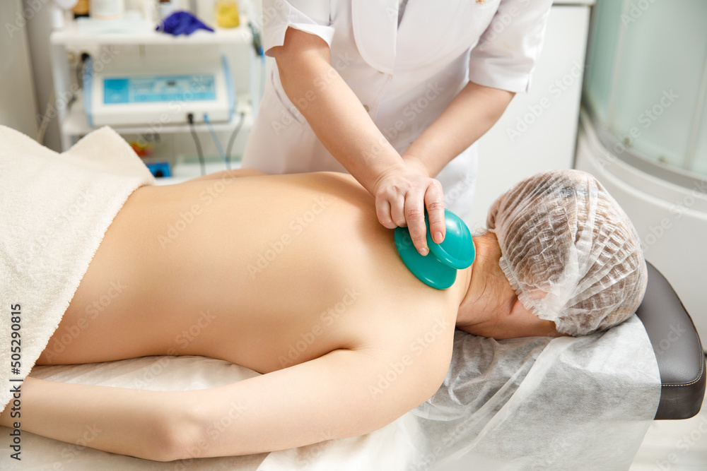 Vacuum massage. Vacuum cups of medical cupping therapy on woman back, close up, chinese medicine.