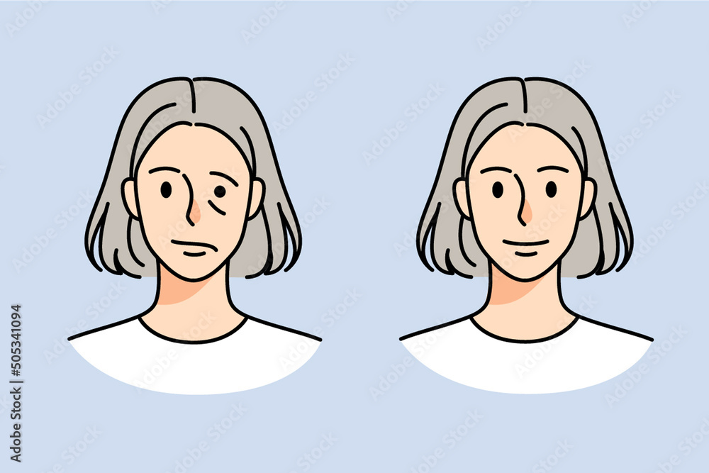 Old woman struggle with facial nerve palsy Old woman struggle with facial nerve palsy
