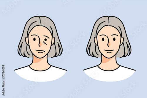 Old woman struggle with facial nerve palsy