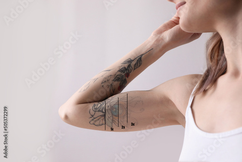 Fotografie Woman before and after laser tattoo removal procedures on light background, clos