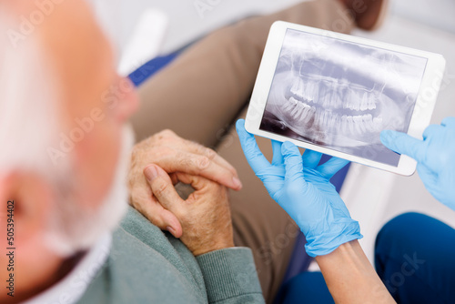 Doctor showing jaw x-ray to senior male patient at dentist office