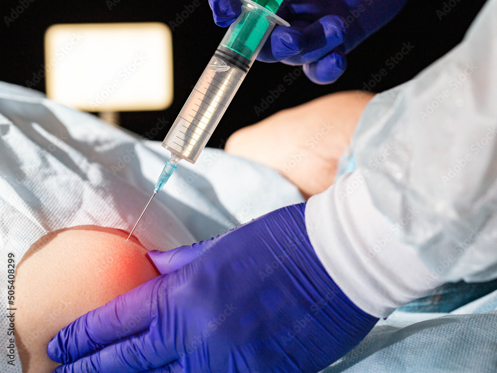 Φωτογραφία The doctor injects an anti-inflammatory drug into the shoulder joint to treat shoulder pain and atrosis