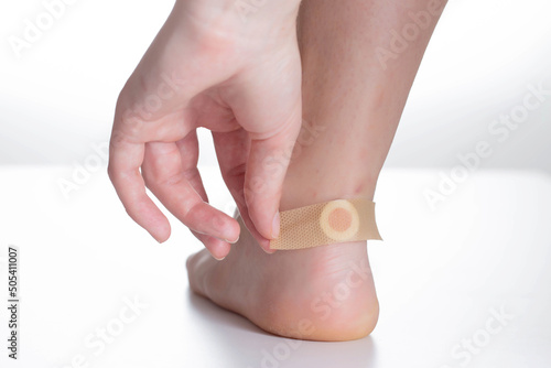 A woman sticks a medical plaster on the heel of her foot for the treatment of corns and keratinized skin, close-up