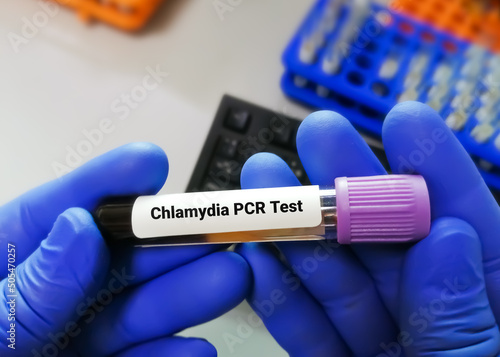 Chlamydia PCR test or  polymerase chain reaction for Chlamydia to detect STD photo