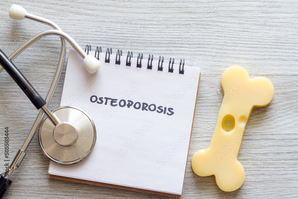 Ταπετσαρία Bone shaped cheese, notebook and stethoscope, concept osteoporosis