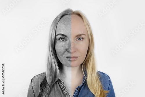 Ultraviolet rays on skin. Protective creams test. On the left, the skin is unprotected and stains from UV exposure are visible on it. On right, skin is clean under the protection of special products.