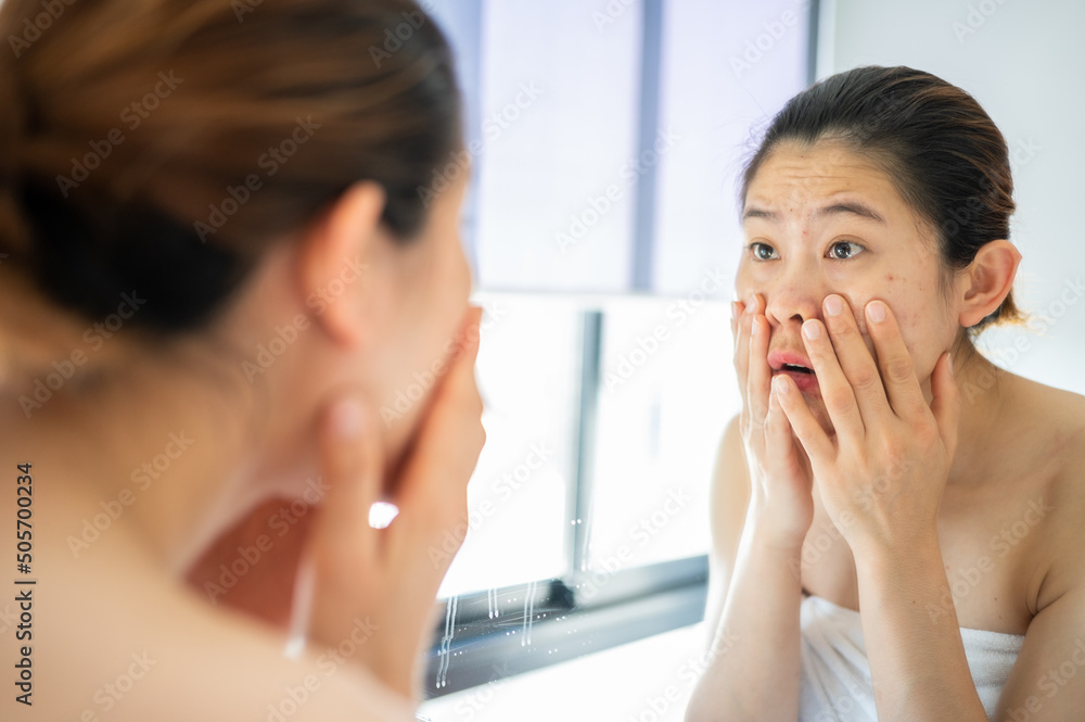 Asian woman feeling stress after looking her face in mirror. She dissatisfied her face caused of acne and scar problem. Asian woman feeling stress after looking her face in mirror. She dissatisfied her face caused of acne and scar problem.