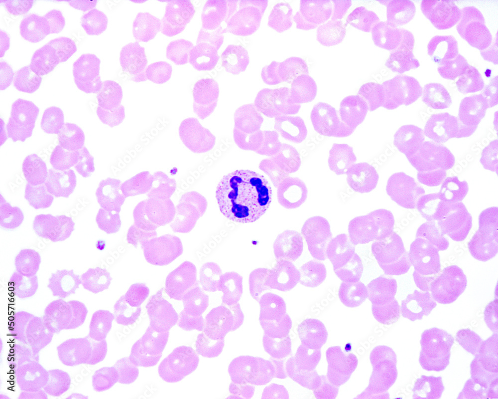 Human blood smear. Neutrophil