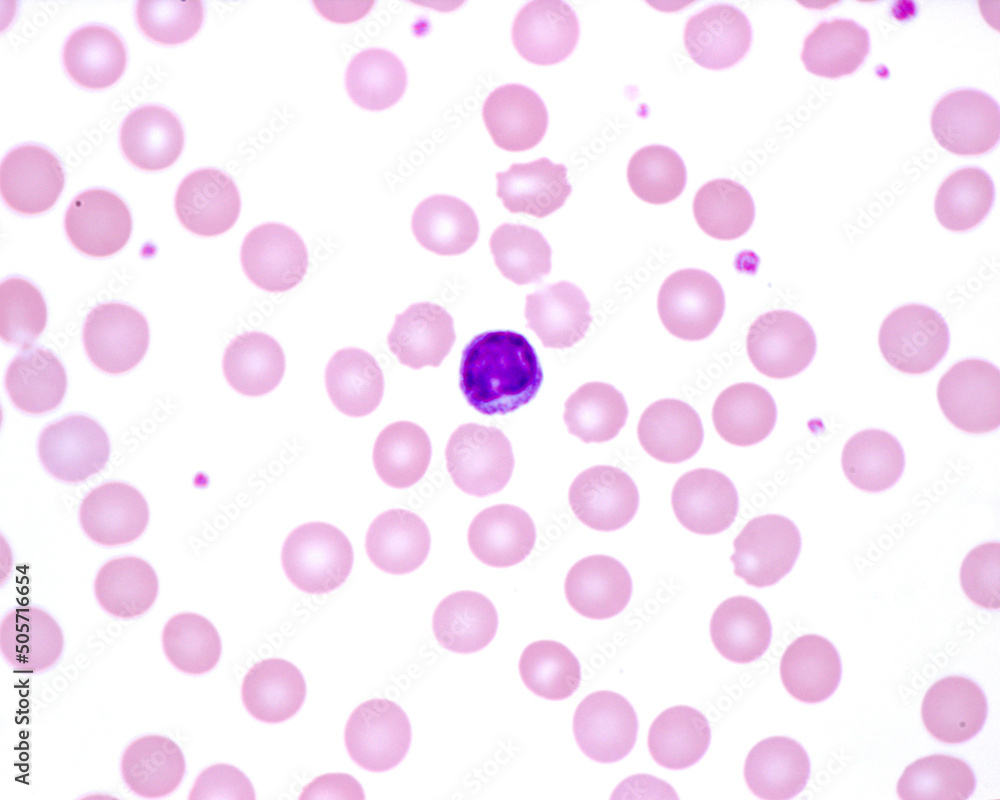Human blood smear. Lymphocyte Human blood smear. Lymphocyte