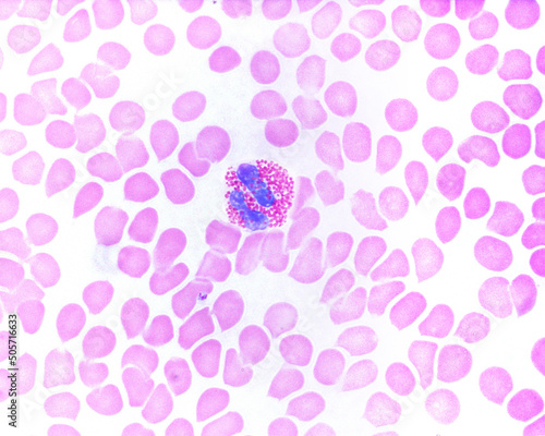 Human blood smear. Eosinophil photo