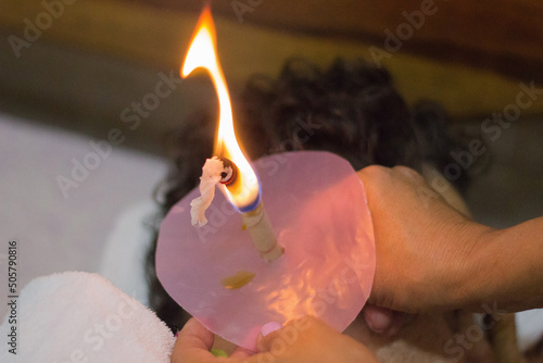 Hindu Cone - Ancient oriental technique helps to eliminate excess mucus, responsible for various diseases including sinusitis. Therapist using candle therapy to treat patient.