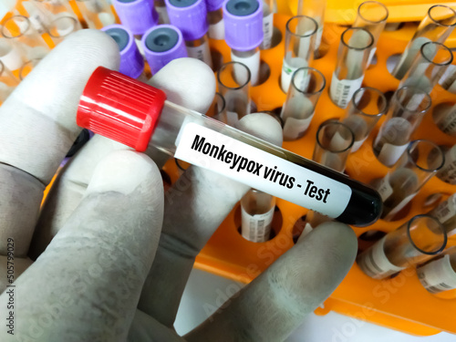 Blood sample tube for Monkeypox virus test. It is also known as the Moneypox virus, is a double-stranded DNA, zoonotic virus and a species of the genus Orthopoxvirus in the family Poxviridae photo