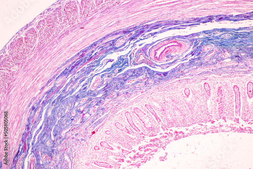
Tissue of Small intestine (Duodenum) and Vermiform appendix  Human under the microscope in Lab.
 photo