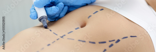 Doctor drawing preoperative marking on patient abdomen closeup photo