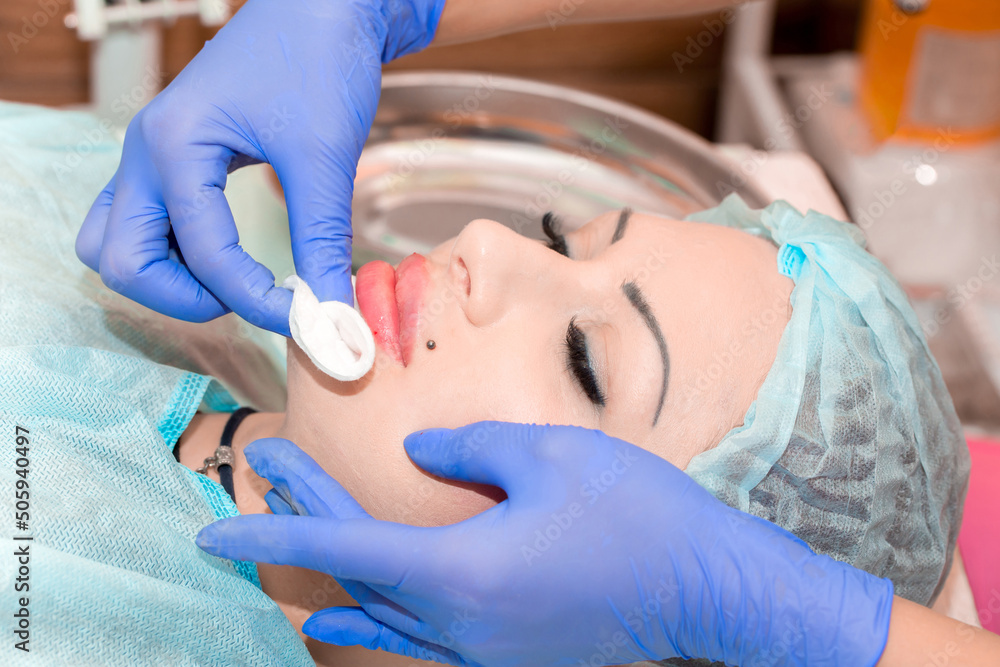 Lip augmentation. Beautician injects hyaluronic acid into the lips of a girl with a syringe. The cosmetologist doctor performs the procedure in the cosmetology office. Plastic surgery. Lip augmentation. Beautician injects hyaluronic acid into the lips of a girl with a syringe. The cosmetologist doctor performs the procedure in the cosmetology office. Plastic surgery.