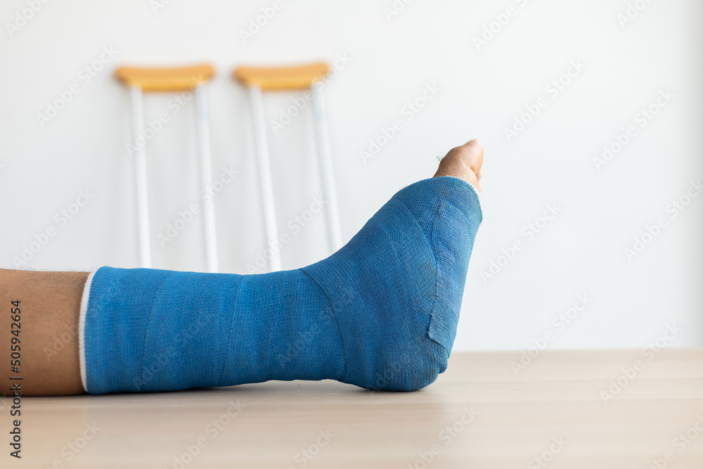 Φωτογραφία Blue ankle and foot splint Bandages on the legs from a young man's fall accident, Blue plaster on the ankle, Crutches assist in the walking of the patient