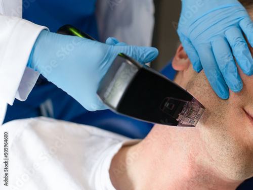 Bild auf Leinwand skin treatment performed on a man. close up