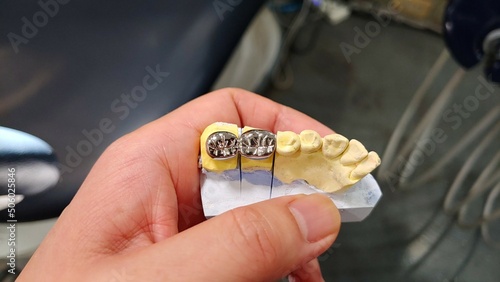 metal crown