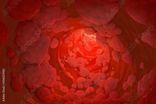 Fat hyperlipidemia or arteriosclerosis hemoglobin red blood vessel cell micro microscope inside interior human body. Embolism and cholesterol and intestinal tumors abstract concept. 3D Illustration. photo