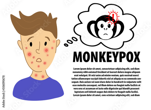 Monkeypox inphographic banner design. Male suffering from new virus Monkeypox. Monkeypox virus alert danger icon sign. flat character portrait with ed rash on face - symptoms of smallpox.