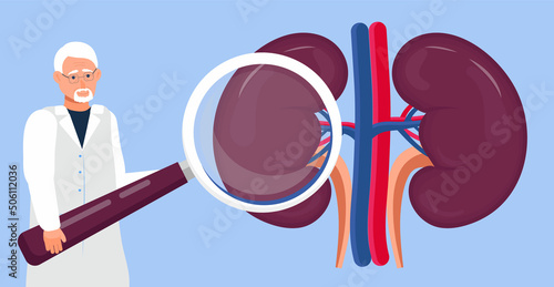 Nephrologist and nephropathy concept vector. Tiny doctors treat, looks through a magnifying glass at kidneys. Pyelonephritis and kidney stones