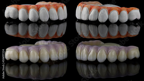 excellent dental collage of a zircon prosthesis  before and after fabrication by a technician on a black background