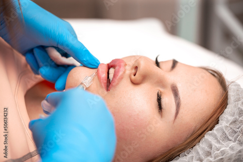 Lip augmentation. Beautician injects hyaluronic acid into the lips of a girl with a syringe. The cosmetologist doctor performs the procedure in the cosmetology office. Plastic surgery.