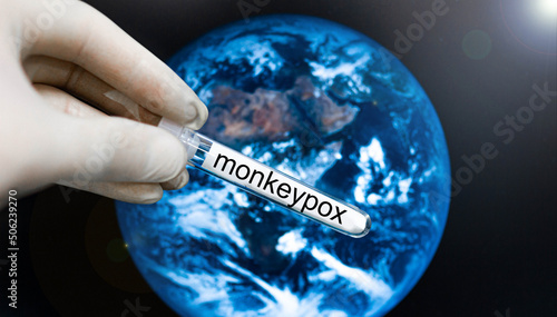 test tube with the monkeypox virus in the hand of a scientist on the background of the planet, the virus is spreading in a pandemic photo