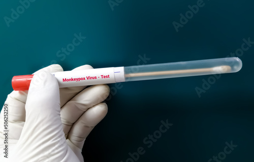 Vesicles fluid sample for Monkeypox virus test. It is also known as the Moneypox virus, a double-stranded DNA virus and member of Poxviridae family. photo